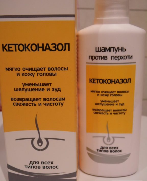 как быстро избавиться от перхоти на голове